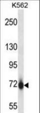 Mouse Pak7 Antibody western blot of K562 cell line lysates (35 ug/lane). The Pak7 antibody detected the Pak7 protein (arrow).