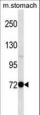 Mouse Pak7 Antibody western blot of mouse stomach tissue lysates (35 ug/lane). The Pak7 antibody detected the Pak7 protein (arrow).