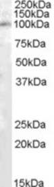 Antibody (1 ug/ml) staining of Human Kidney lysate (35 ug protein in RIPA buffer). Primary incubation was 1 hour. Detected by chemiluminescence.