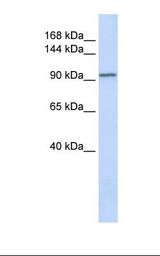 721_B cell lysate. Antibody concentration: 1.0 ug/ml. Gel concentration: 6-18%.