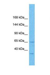Western blot of Human Stomach Tumor. PAM antibody dilution 1.0 ug/ml.