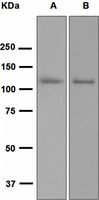 Western blot analysis on (A) fetal heart and (B) PC-3 cell lysates using anti-PAM antibody. Note: Dilute primary antibody in 1% BSA.
