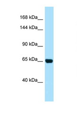 PALB2 antibody LS-C146550 Western blot of HeLa Cell lysate. Antibody concentration 1 ug/ml.