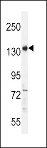 PALB2 Antibody western blot of HepG2 cell line lysates (35 ug/lane). The PALB2 antibody detected the PALB2 protein (arrow).