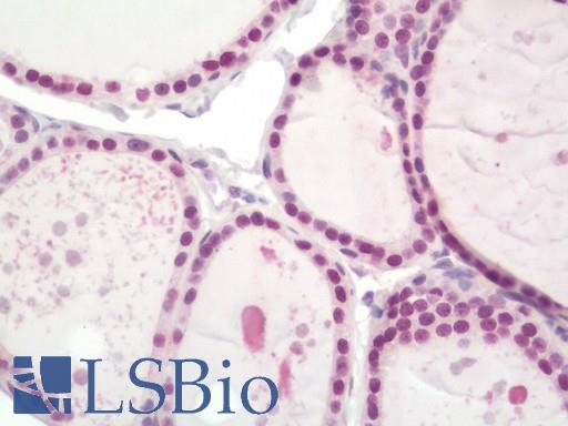 Human Thyroid: Formalin-Fixed, Paraffin-Embedded (FFPE)