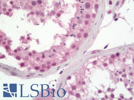 Human Testis: Formalin-Fixed, Paraffin-Embedded (FFPE)