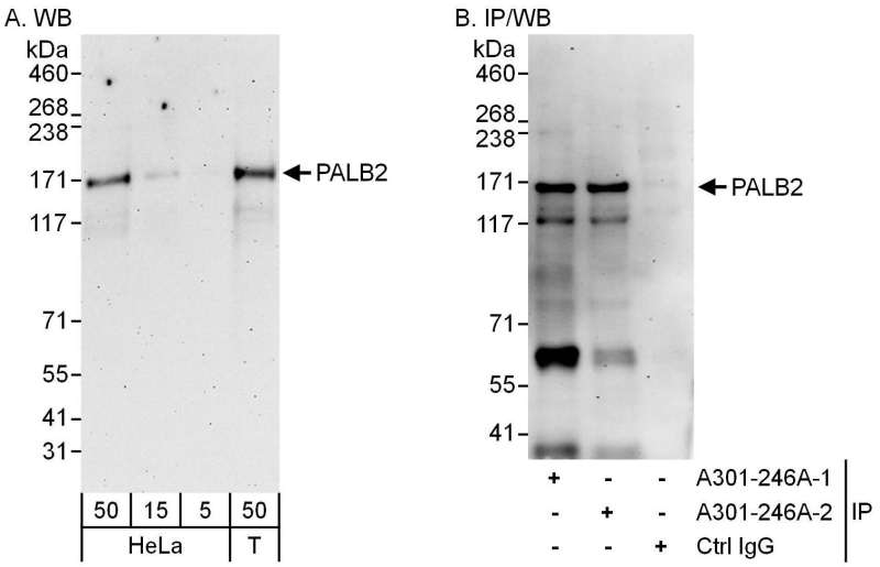 Detection of Human PALB2 by Western Blot and Immunoprecipitation. Samples: Whole cell lysate from HeLa (5, 15 and 50 ug for WB; 1 mg for IP, 20% of IP loaded) and 293T (T; 50 ug) cells. Antibodies: Affinity purified rabbit anti-PALB2 antibody used for WB at 0.1 ug/ml (A) and 1 ug/ml (B) and used for IP at 6 ug/mg lysate. PALB2 was also immunoprecipitated by a previous lot of this antibody. Detection: Chemiluminescence with exposure times of 3 minutes (A and B).