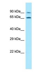 PALMD antibody Western Blot of Jurkat.