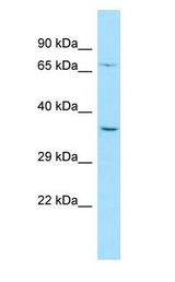 PALMD antibody Western Blot of MCF7.