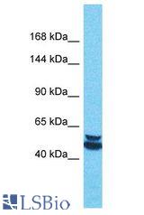 PALMD antibody Western Blot of Thymus Tumor. Antibody dilution: 1 ug/ml.