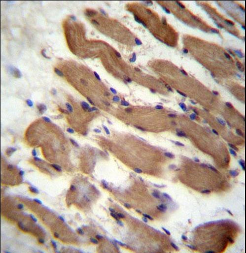 PALMD Antibody immunohistochemistry of formalin-fixed and paraffin-embedded human skeletal muscle followed by peroxidase-conjugated secondary antibody and DAB staining.