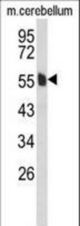 Western blot of MPP6 Antibody in mouse cerebellum tissue lysates (35 ug/lane). MPP6 (arrow) was detected using the purified antibody.