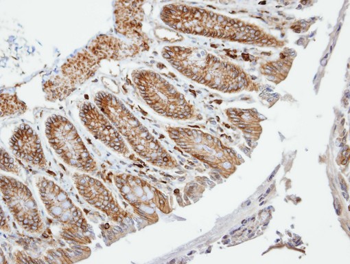 IHC of paraffin-embedded Colon using VAM1 antibody at 1:100 dilution.