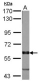 Sample (50 ug of whole cell lysate). A: Rat brain. 7.5% SDS PAGE. PALS2 / MPP6 antibody diluted at 1:1000.