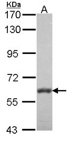 Sample (30 ug of whole cell lysate). A: NT2D1. 7.5% SDS PAGE. PALS2 / MPP6 antibody diluted at 1:1000.