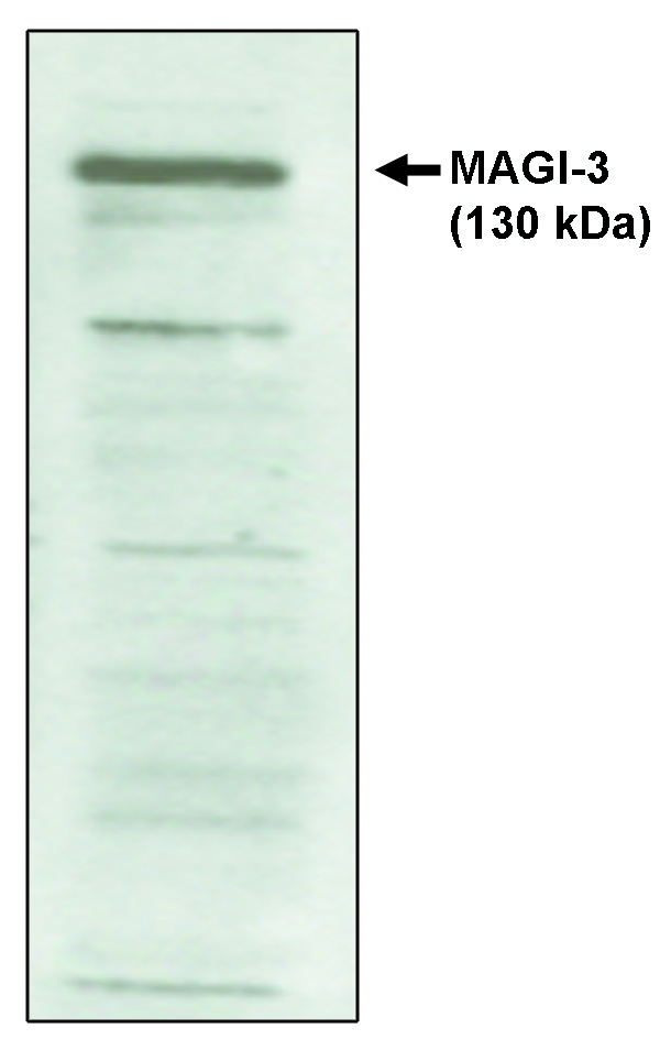 Western blot of MAGI-3, PDZ 4-5 antibody on cell lysates transfected with full-length human MAGI-3 protein.