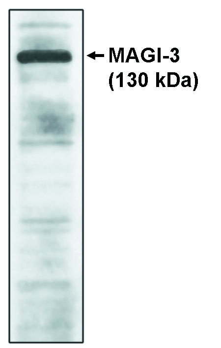 Western blot of MAGI-3, GKWW antibody on cell lysates transfected with full-length human MAGI-3 protein.