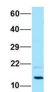 PAM16 antibody Western Blot of HeLa lysate. Antibody Dilution: 1.0ug/ml. PAM16 is supported by BioGPS gene expression data to be expressed in HeLa. Antibody dilution: 1 ug/ml.