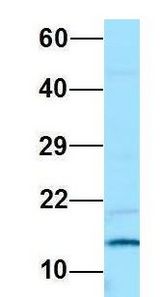 PAM16 antibody Western Blot of Jurkat lysate. Antibody Dilution: 1.0 ug/ml. PAM16 is supported by BioGPS gene expression data to be expressed in Jurkat. Antibody dilution: 1 ug/ml.