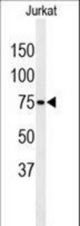 Western blot of PAN3 Antibody in Jurkat cell line lysates (35 ug/lane). PAN3 (arrow) was detected using the purified antibody.