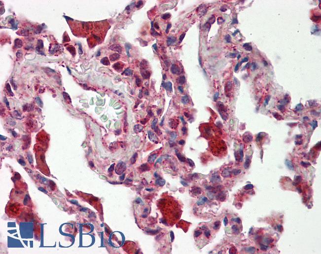Anti-PAN3 antibody IHC staining of human lung. Immunohistochemistry of formalin-fixed, paraffin-embedded tissue after heat-induced antigen retrieval.