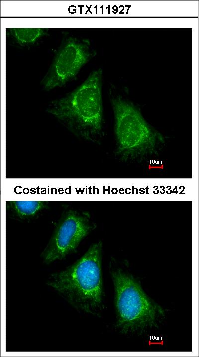 Immunofluorescence of methanol-fixed HeLa, using PAN3 antibody at 1:200 dilution.