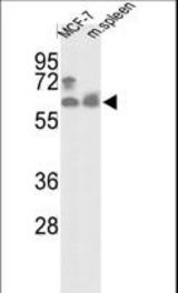 Western blot of hPANK1-R90 in MCF-7 cell line and mouse spleen tissue lysates (35 ug/lane). PANK1 (arrow) was detected using the purified antibody.