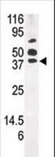 Western blot of anti-PANK1 antibody in mouse kidney tissue lysate (35 ug/lane). PANK1(arrow) was detected using the purified antibody.
