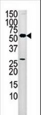 Western blot of anti-PANK2 antibody in mouse liver tissue lysate (35 ug/lane). PANK2(arrow) was detected using the purified antibody.
