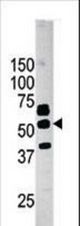 Western blot of anti-PANK2 antibody in mouse liver tissue lysate (35 ug/lane). PANK2(arrow) was detected using the purified antibody.