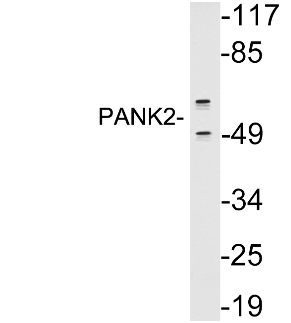 Western blot of extracts from A549 cells, using PANK2 antibody.