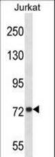MFN1 Antibody western blot of Jurkat cell line lysates (35 ug/lane). The MFN1 antibody detected the MFN1 protein (arrow).