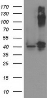 HEK293T cells were transfected with the pCMV6-ENTRY control (Left lane) or pCMV6-ENTRY PANK3 (Right lane) cDNA for 48 hrs and lysed. Equivalent amounts of cell lysates (5 ug per lane) were separated by SDS-PAGE and immunoblotted with anti-PANK3.
