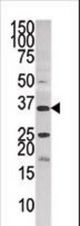 Western blot of anti-PANK3 in HepG2 cell line lysate (35 ug/lane). PANK3(arrow) was detected using the purified antibody.