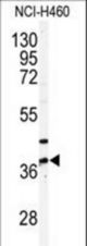 Western blot of anti-PANK3 Antibody in NCI-H460 cell line lysates (35 ug/lane). PANK3(arrow) was detected using the purified antibody.