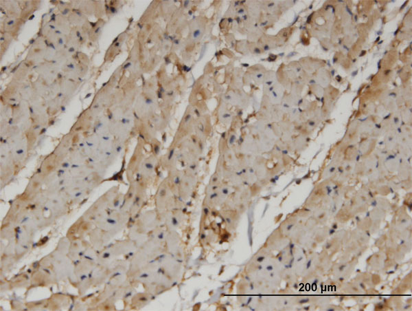 Immunoperoxidase of monoclonal antibody to PANK4 on formalin-fixed paraffin-embedded human heart. [antibody concentration 3 ug/ml]