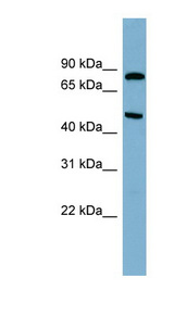 PANK4 antibody LS-C111986 Western blot of 721_B cell lysate.
