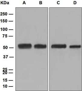 Western blot analysis on (A) fetal brain, (B) SH-SY5Y, (C) Caco-2, and (D) NIH: OVCAR-3 cell lysates using anti-Pannexin 1 antibody.