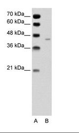A: Marker, B: Jurkat Cell Lysate