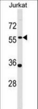 PANX1 Antibody western blot of Jurkat cell line lysates (35 ug/lane). The PANX1 antibody detected the PANX1 protein (arrow).