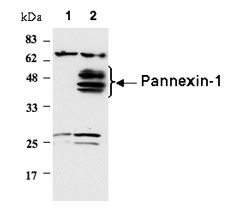 Western blot of human Pannexin-1 by PAb to Pannexin-1 (human) (AT124). Cell extracts of HEK 293T mock-transfected (lane 1) or transfected with an expression vector encoding for human Pannexin-1 (lane 2) were run on a SDS-PAGE gel and analyzed by Western blot. After transfer, the nitrocellulose membrane was probed with PAb to Pannexin-1 (human) (AT124) at 1:1000 for 1 hour at room temperature, and then incubated with an anti-rabbit horseradish peroxidase (1:4000).