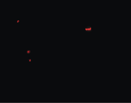 Immunofluorescence of PANX1 in human ovary tissue with PANX1 antibody at 20 ug/ml.