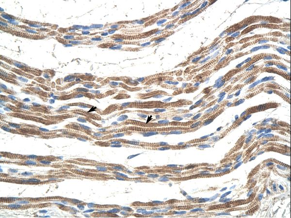 PANX2 / Pannexin 2 antibody LS-C31840 was used in IHC to stain formalin-fixed, paraffin-embedded human muscle.