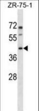 PANX3 Antibody western blot of ZR-75-1 cell line lysates (35 ug/lane). The PANX3 antibody detected the PANX3 protein (arrow).