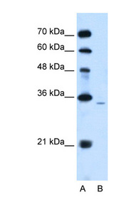 PPAP2A antibody LS-C40365 Western blot of Jurkat lysate.