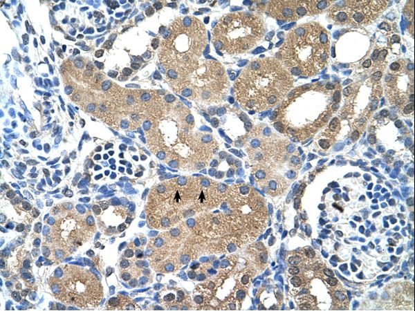 PPAP2A antibody LS-C31901 was used in IHC to stain formalin-fixed, paraffin-embedded human kidney.
