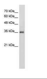 HepG2 Cell Lysate