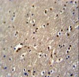 GLD2 Antibody immunohistochemistry of formalin-fixed and paraffin-embedded human brain tissue followed by peroxidase-conjugated secondary antibody and DAB staining.