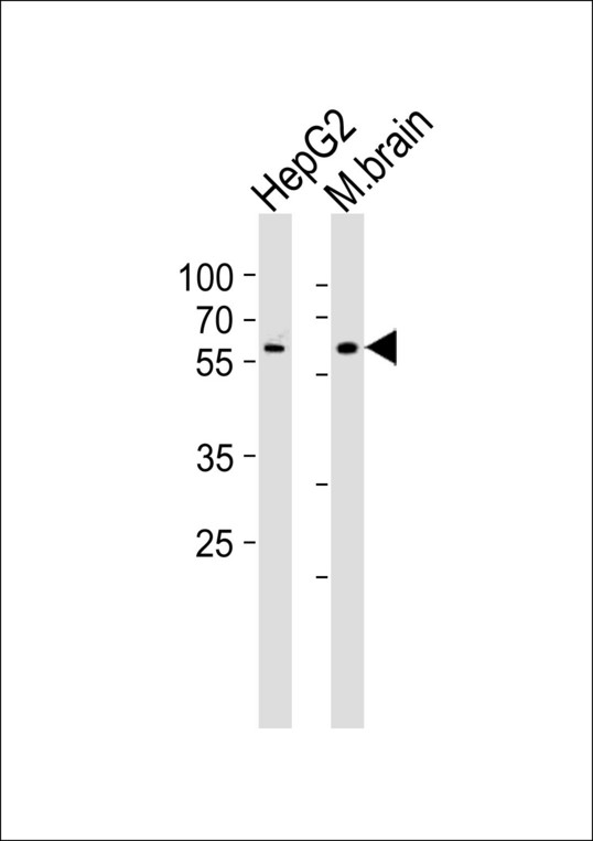 Western blot of lysates from HepG2 cell line and mouse brain tissue lysate (from left to right), using GLD2 Antibody. Antibody was diluted at 1:1000 at each lane. A goat anti-rabbit IgG H&L (HRP) at 1:10000 dilution was used as the secondary antibody. Lysates at 35ug per lane.
