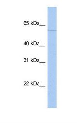 MCF7 cell lysate. Antibody concentration: 1.0 ug/ml. Gel concentration: 12%.